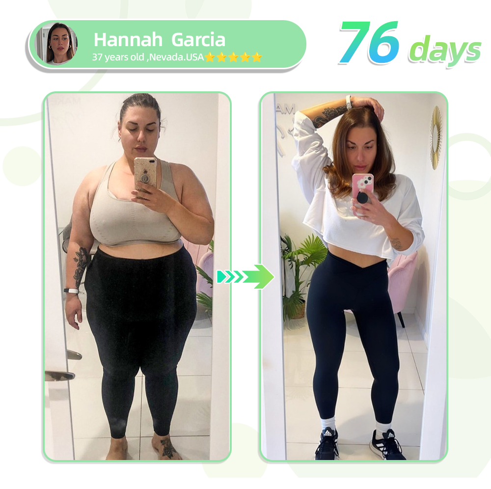 LOVILDS™ SMGT-GLP-1 Nano Microneedle Patch（Painless, long-lasting, addressing diabetes, obesity, and cardiovascular diseases）